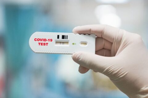 Kemenkes Patok Tarif Tertinggi Rapid Test Corona Rp 150 Ribu